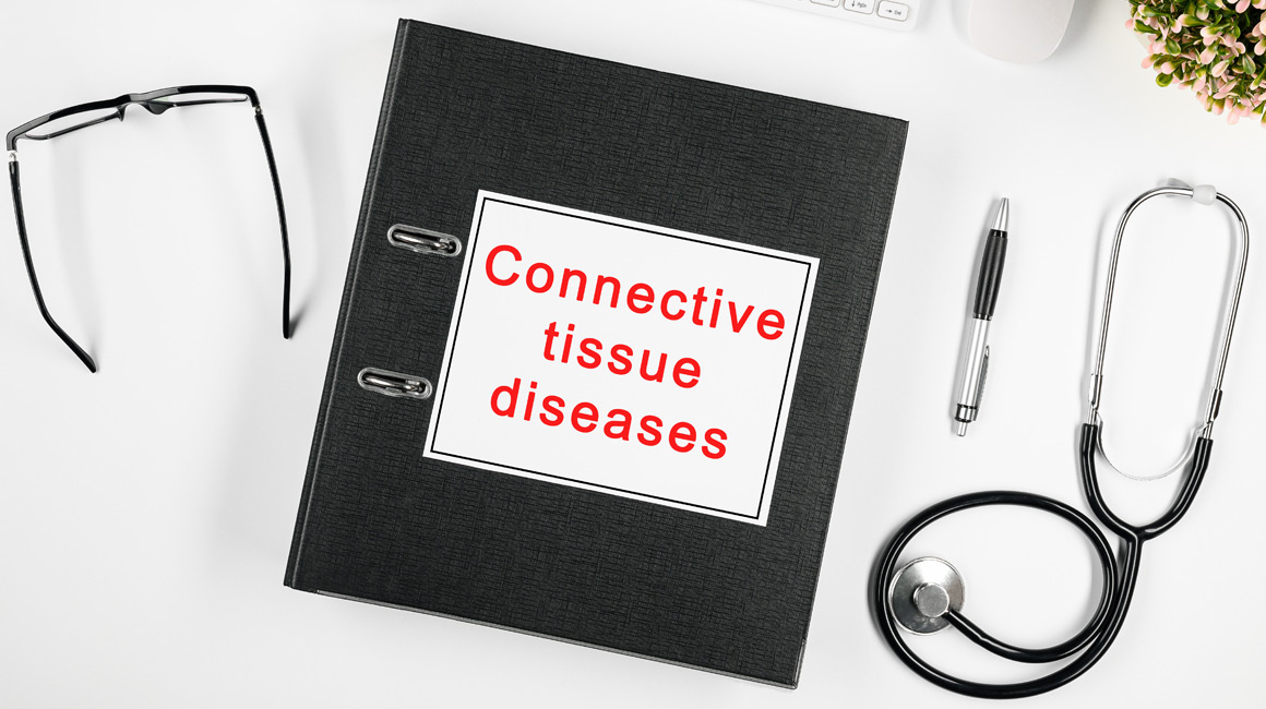 Connective Tissue Disease