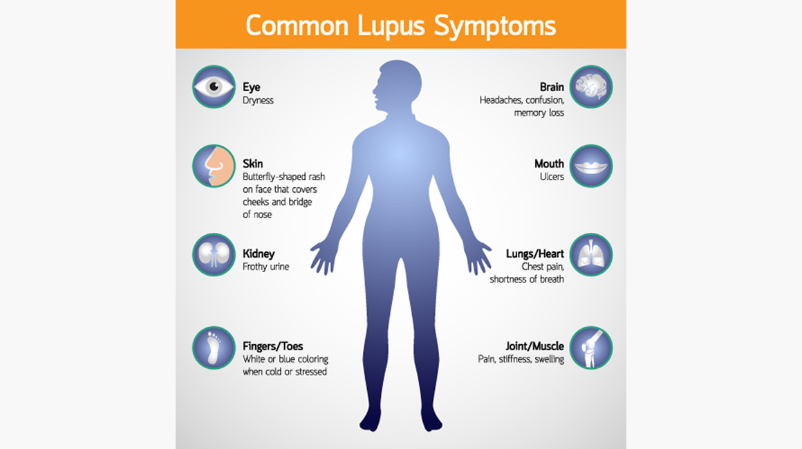 lupus and rheumatoid arthritis symptoms